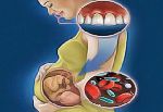 علاج الأسنان عند المرأة الحامل مهم جداً 
