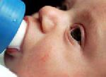 L’allergie au lait chez les bébés